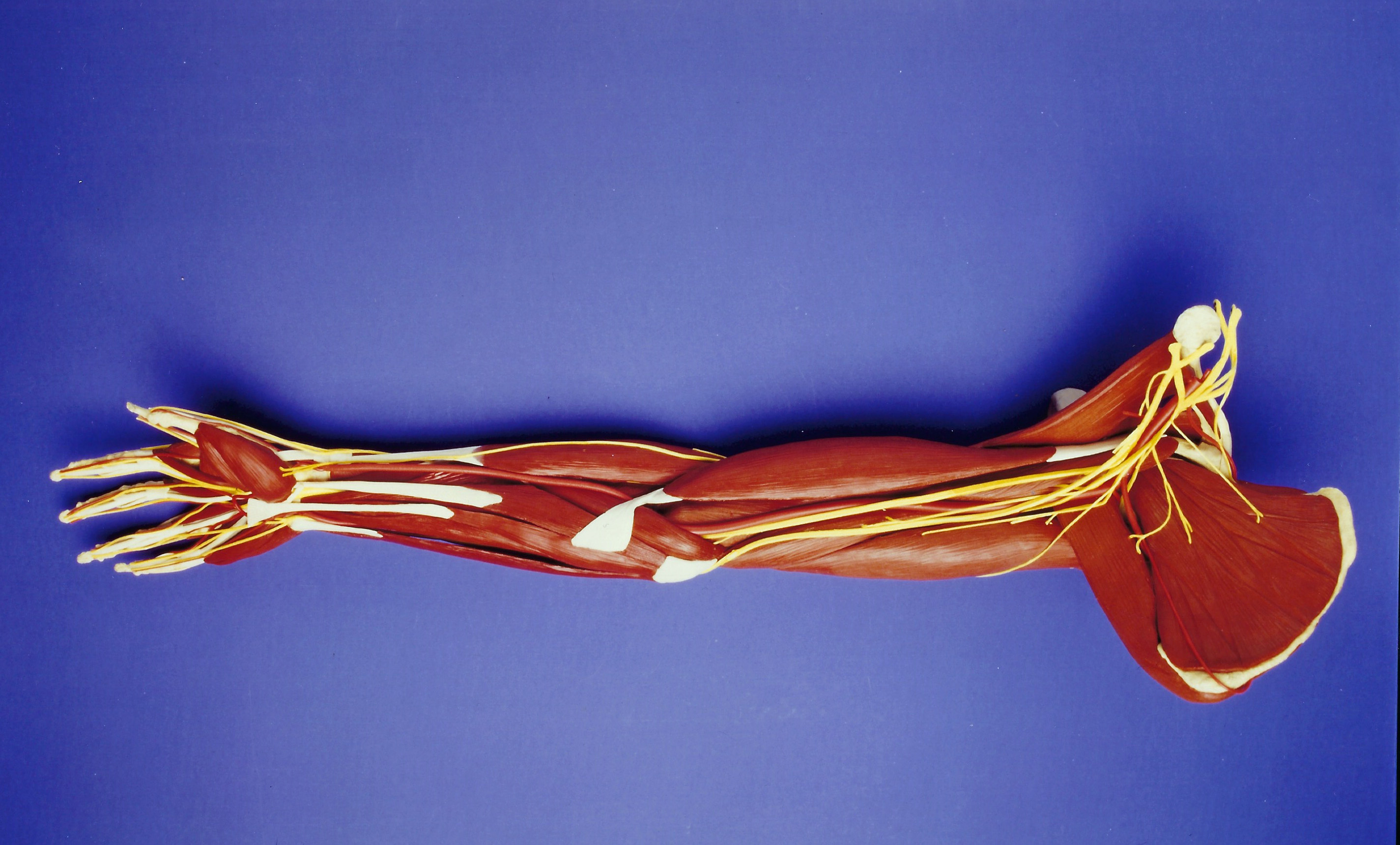 Baldomero Arm model: full view